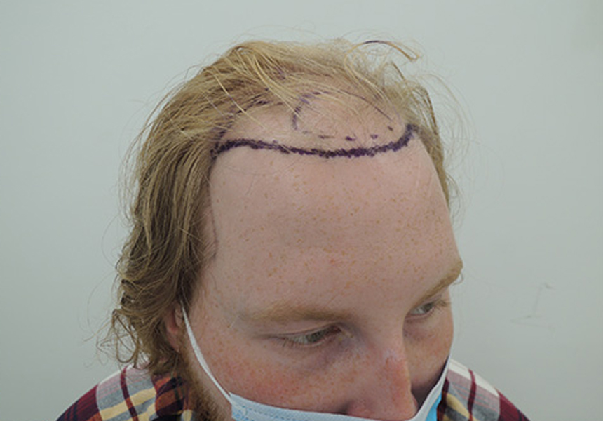 Image of Rhys before the treatment