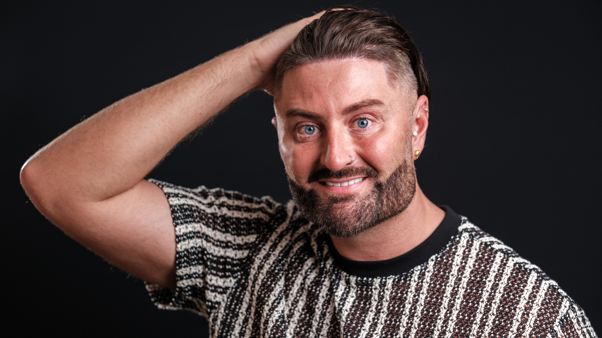 Danny's Hair Transplant Story