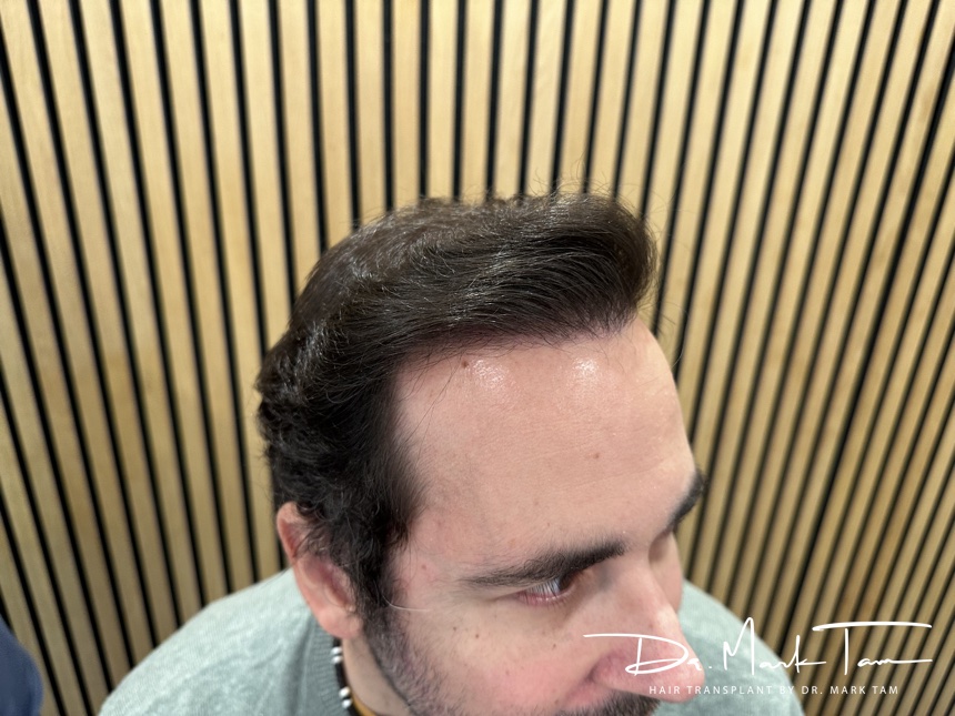 Image of Massimo