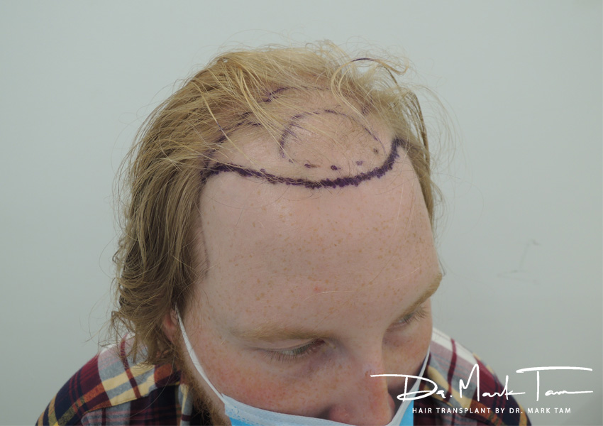 Image of Rhys before the treatment