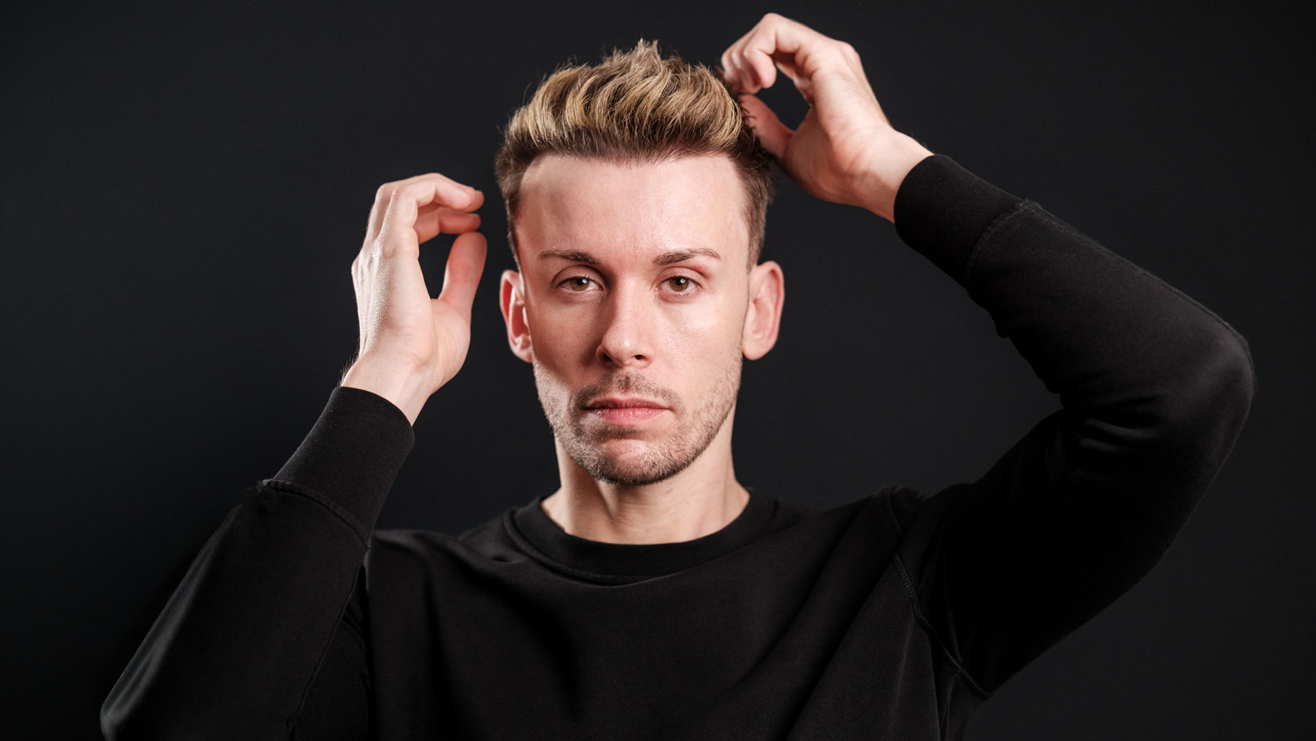 Stuart's Hair Transplant Story