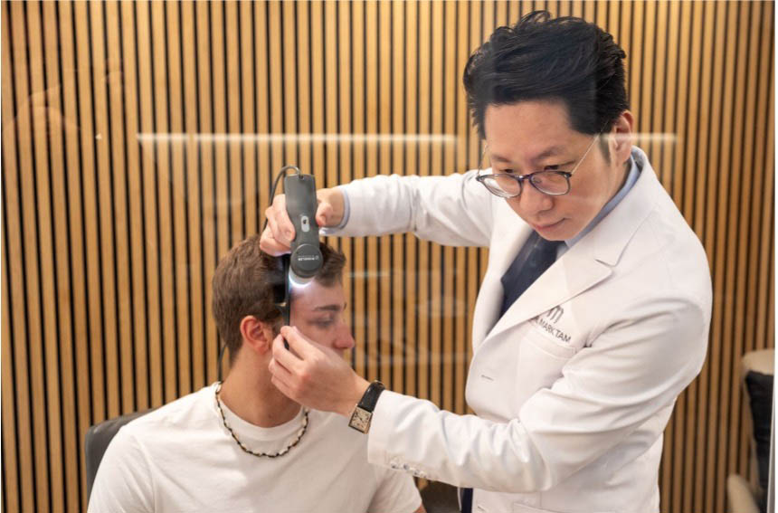 FUE Hair Transplants in London