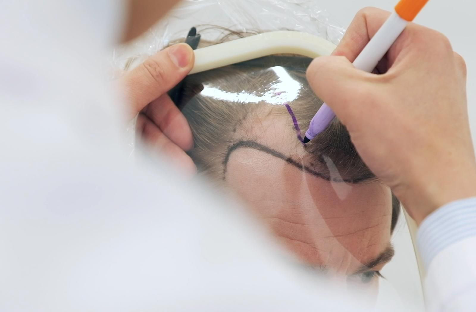 The Hair Restoration Surgery Mentorship Programme
